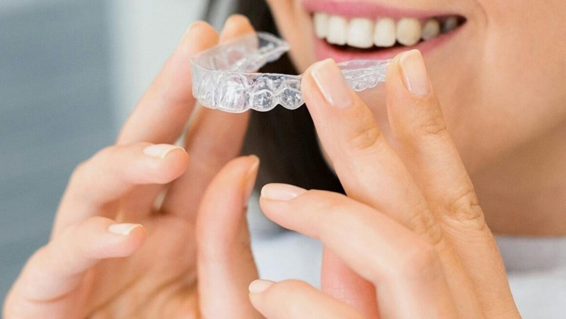 Invisalign pris