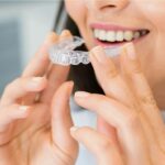 Invisalign pris