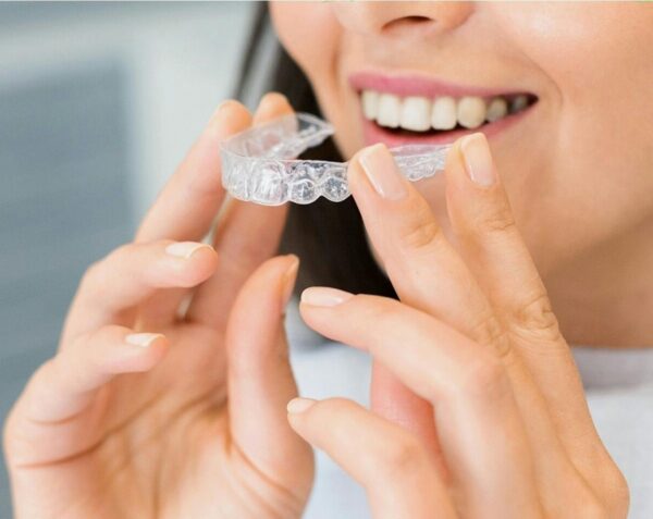 Invisalign pris: derfor bliver behandlingen dyrere end budgetteret